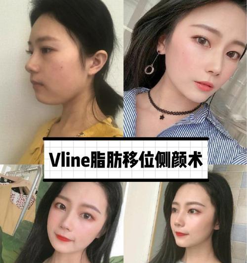 瘦双下巴最有效的方法是什么?如何快速消除双下巴?