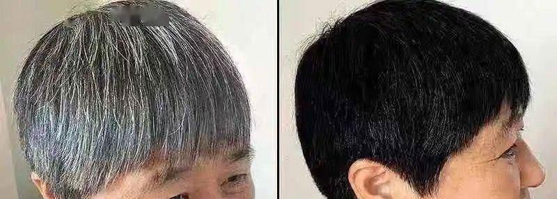 白发变黑发最好的方法是什么？有效自然的解决方案有哪些？
