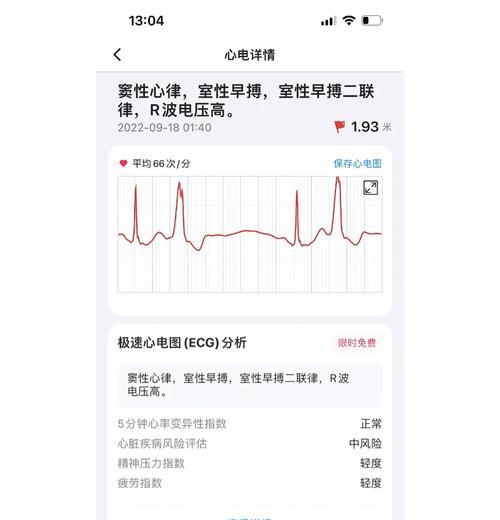 苹果手表心率检测功能如何启用?